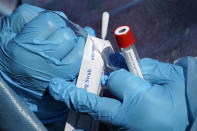 FILE - In this Thursday, Dec. 10, 2020 file photo, a registered nurse opens a swab during testing for COVID-19 in south Philadelphia. On Friday, March 5, 2021, The Associated Press reported on stories circulating online incorrectly asserting nasal swabs used for COVID-19 tests contain Morgellons disease fibers that are being put in your brain when you are tested for the virus. Since the pandemic was declared in 2020, posts online have falsely speculated that COVID-19 tests are being used to inject Americans with microchips, nanoparticles and now disease “fibers” into the brain. (AP Photo/Matt Slocum)