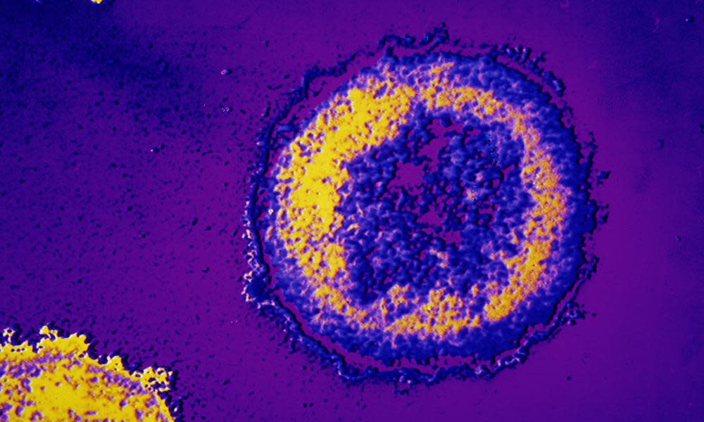 The HIV virus seen through a microscope. There are fears a reduction of services in London could see infection levels rise again.