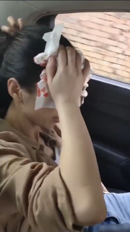 黄聖依拍戲頭被砸傷，趕車急診濺血畫面曝光。（圖／翻攝自微博）