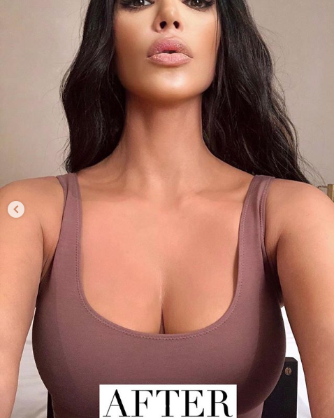 Is Kim Kardashian West's method of using body makeup on psoriasis safe?