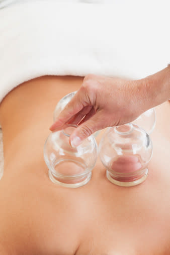 While acupuncture and herbal medicine are the two most well known types of Chinese medicine, traditional practitioners also use acupressure, cupping and the burning of moxa (a herb) over points on the body in order to stimulate the flow of qi.