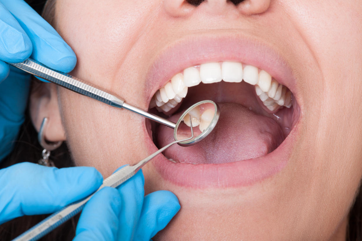 Closeup of dentist tools and mouth open with beautiful teeth