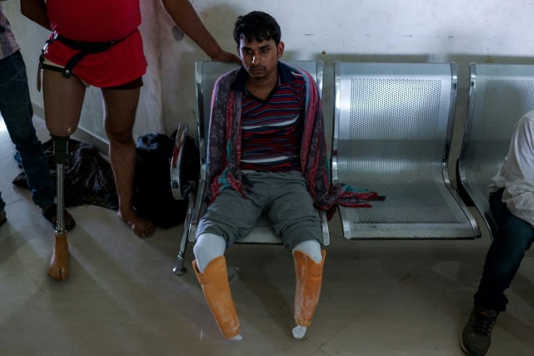 In this photograph taken on June 13, 2017, 22-year-old electrician Vishnu Kumar, who lost his legs and hands in an accident, waits for his rubber-based prosthetic legs and hands at the Bhagwan Mahaveer Viklang Sahayata Samiti non-profit organisation