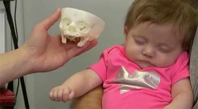 A skull of Sofia's head was made. Source: Today Tonight