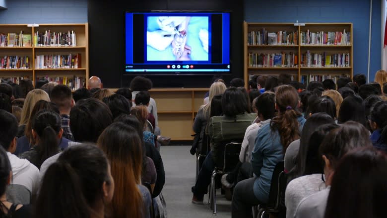 'It's cooler watching it live': Students take live streamed surgery in stride