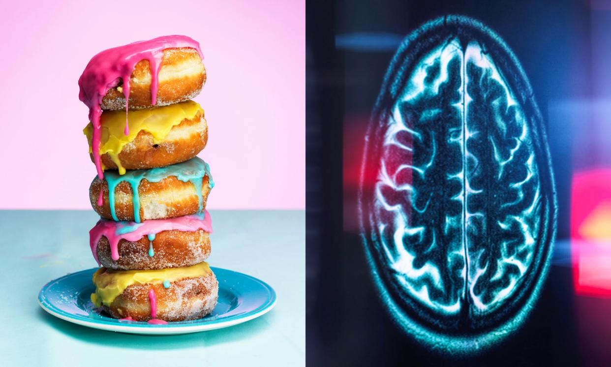 <span>Sugar is much like anything else that ‘lights up the parts of the brain that make us feel nice’.</span><span>Composite: Getty Images</span>