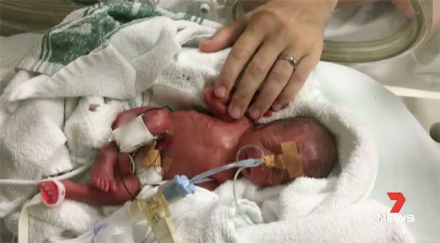 Little Jack Sadgrove was born at 24 weeks. Picture: 7 News