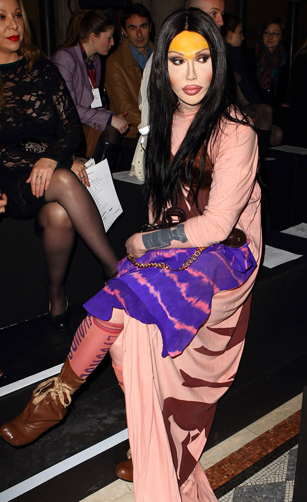 Pete Burns in 2011. (Photo: Mike Marsland/WireImage) 