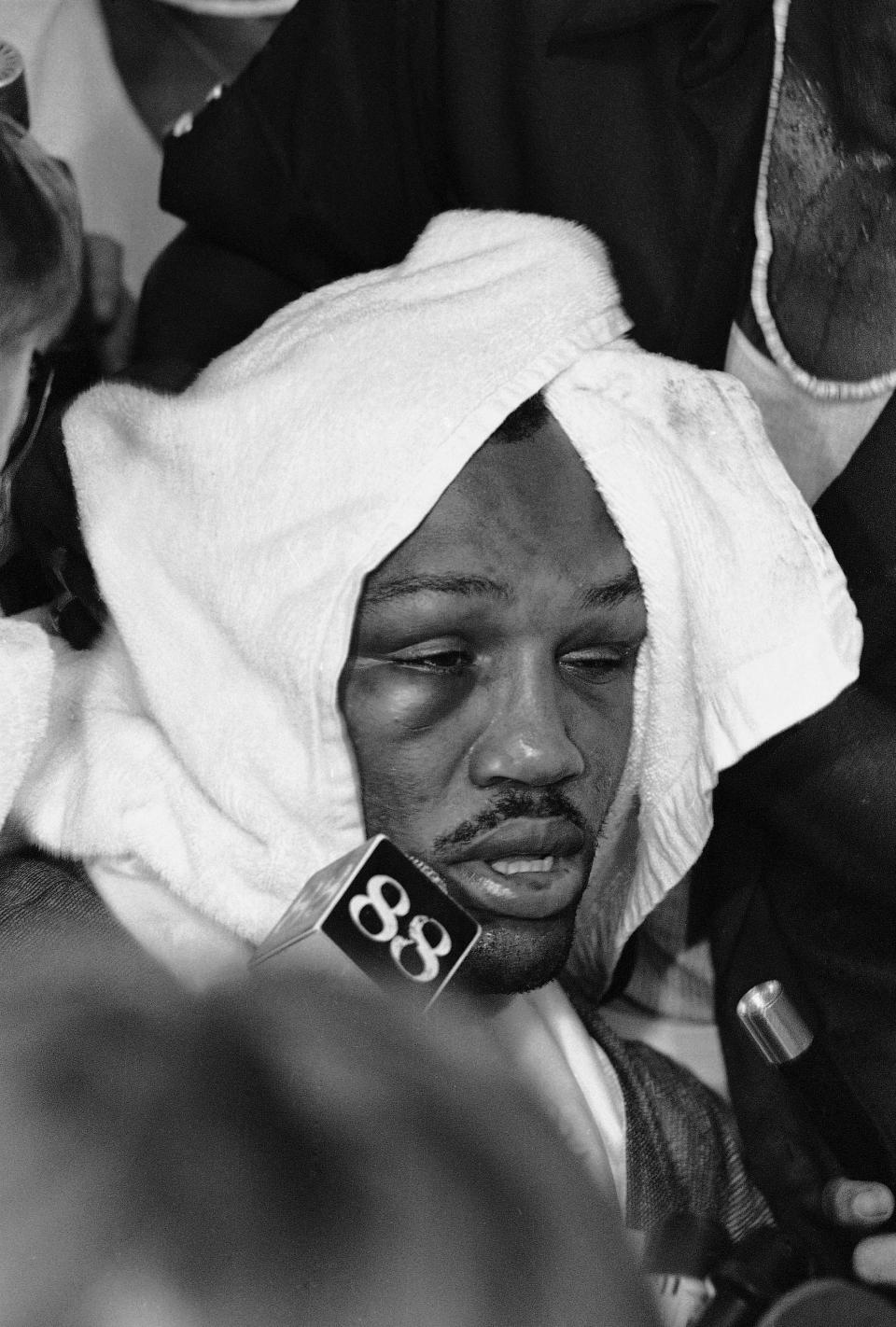 In this Oct. 1, 1975 file photo, a swollen right eye is apparent on Joe Frazier’s face as he is almost covered over by a towel in Manila, Philippines after losing by TKO in the 14th round to heavyweight champion Muhammad Ali at the Coliseum. Frazier, the former heavyweight champion who handed Muhammad Ali his first defeat yet had to live forever in his shadow, died Monday Nov. 7, 2011, after a brief fight with liver cancer. He was 67. (AP Photo/MC/KM, File)