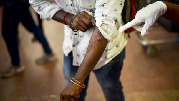 PHOTO: Health workers screen passengers arriving from high-risk countries for symptoms of the Monkeypox virus in Chennai, India, July 16, 2022. (Idrees Mohammed/EPA-EFE/Shutterstock)