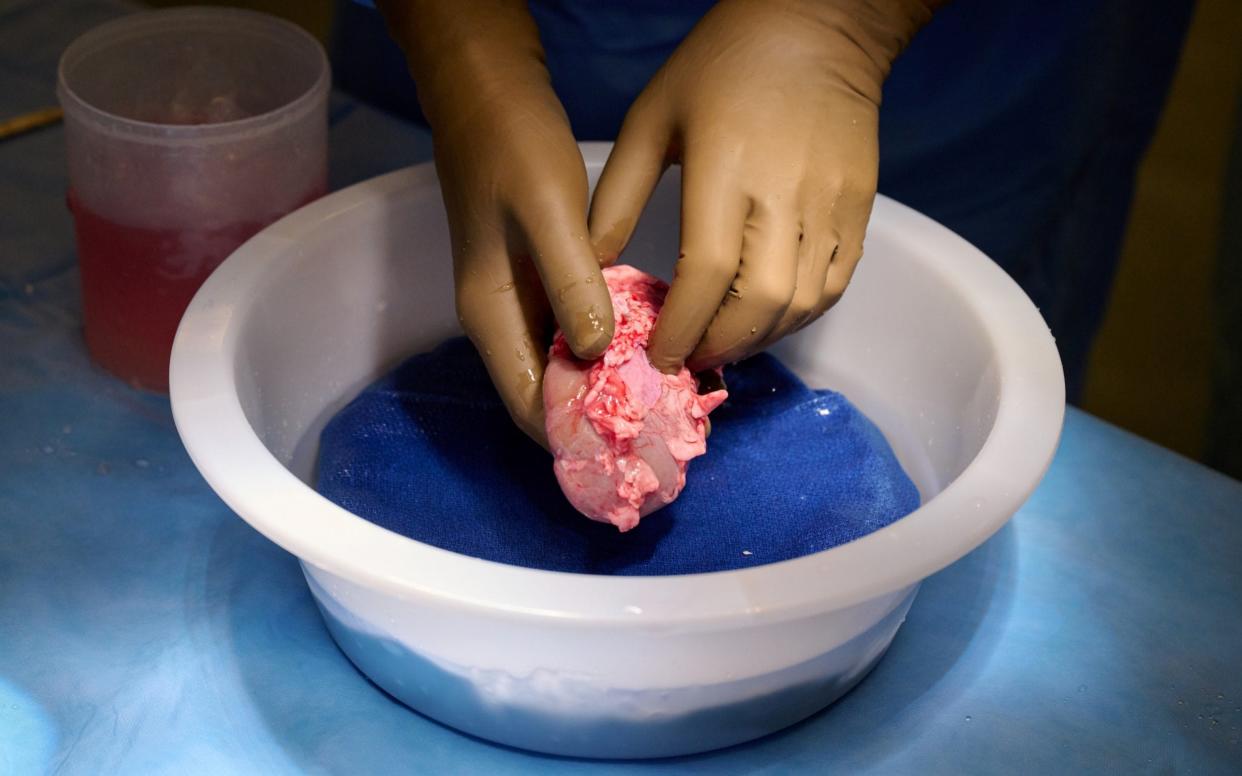 A genetically engineered pig kidney is cleaned and prepared for transplantation to a human at NYU Langone in New York - Joe Carrotta for NYU Langone Health/Handout via REUTERS 