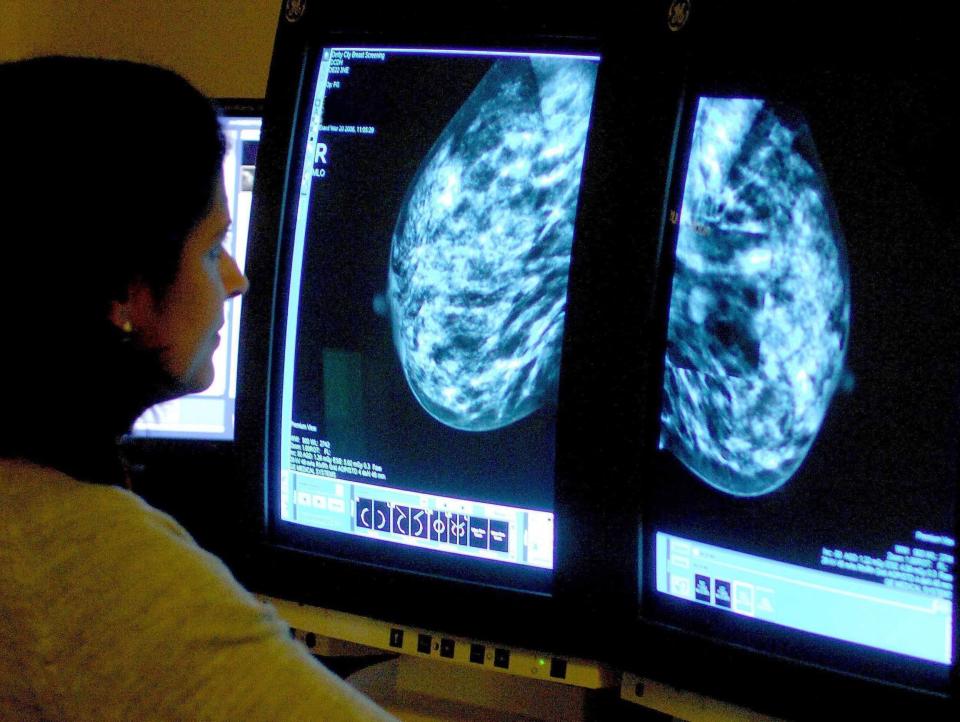 A medical staffer checking a mammogram (PA Wire)