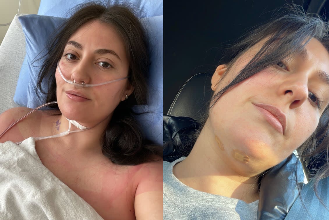 Canadian influencer Sarah DeMelo marked one year since her cancer diagnosis. (Submitted)