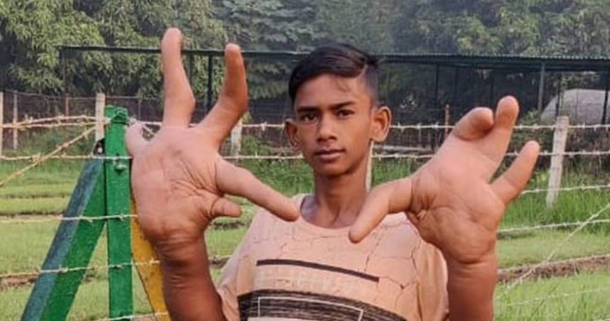 印度一名16歲的少年穆罕默德從小就擁有一雙長約61公分的「巨手」。（圖／翻攝自推特）