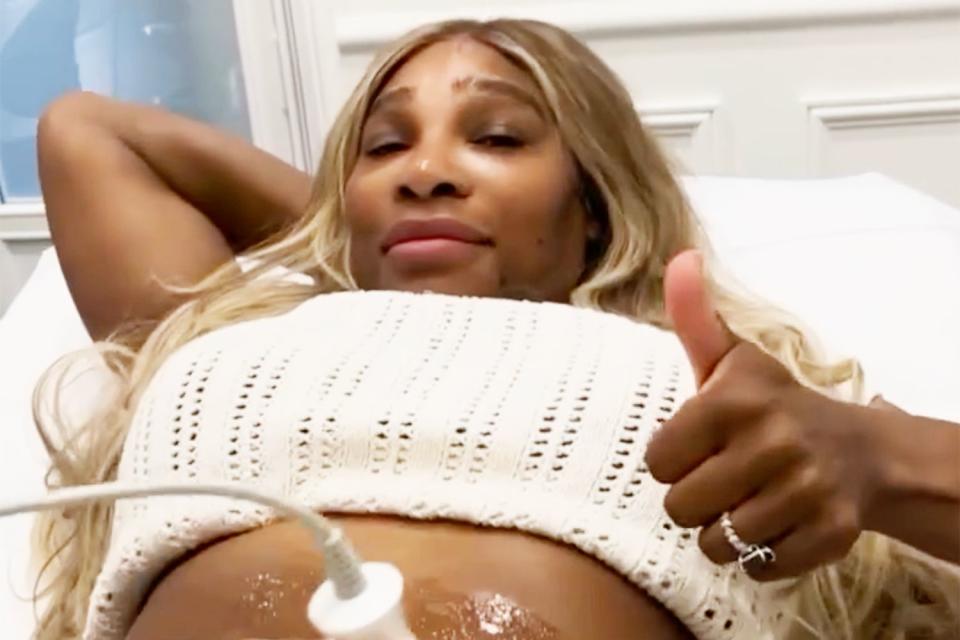 <p>Serena Williams/Instagram</p> Serena Williams shares video of a skin tightening procedure on her Instagram.