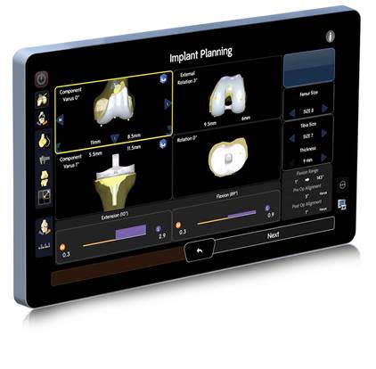 機械人系統提供三維（3D）圖像反映骨骼於手術時的情況。