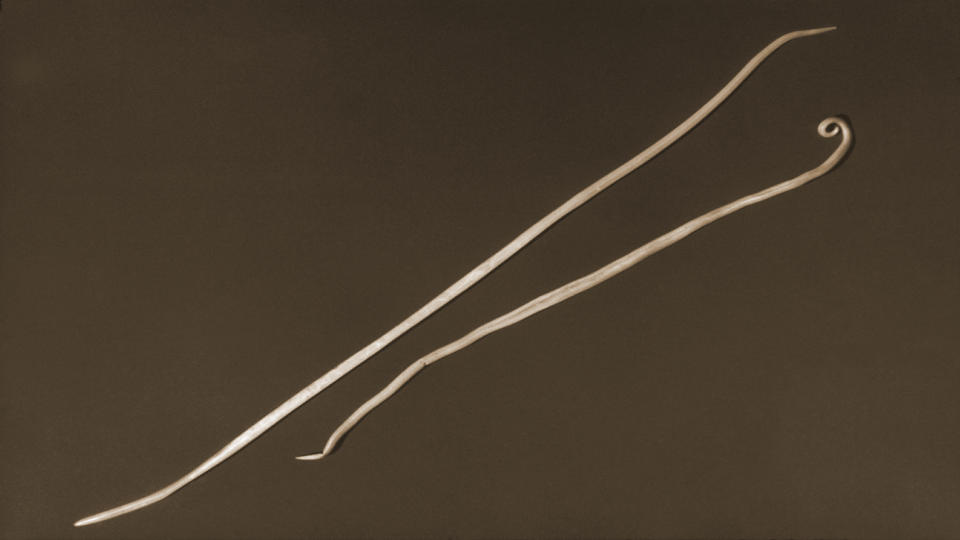 An image of Ascaris lumbricoides nematodes, which are a type of roundworm.