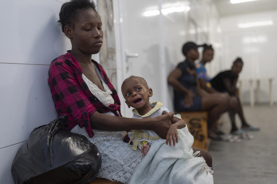 ARCHIVO - Un niño malnutrido espera a ser atendido en la sala de urgencias del hospital de Médicos Sin Fronteras en el vecindario de Cite Soleil, Puerto Príncipe, el viernes 19 de abril de 2024. Hace mucho que el sistema de salud de Haití era frágil, pero ahora se acerca al colapso total después de que las pandillas lanzaran ataques coordinados el 29 de febrero contra infraestructura crítica en la capital y otros lugares. (AP Foto/Ramon Espinosa, Archivo)