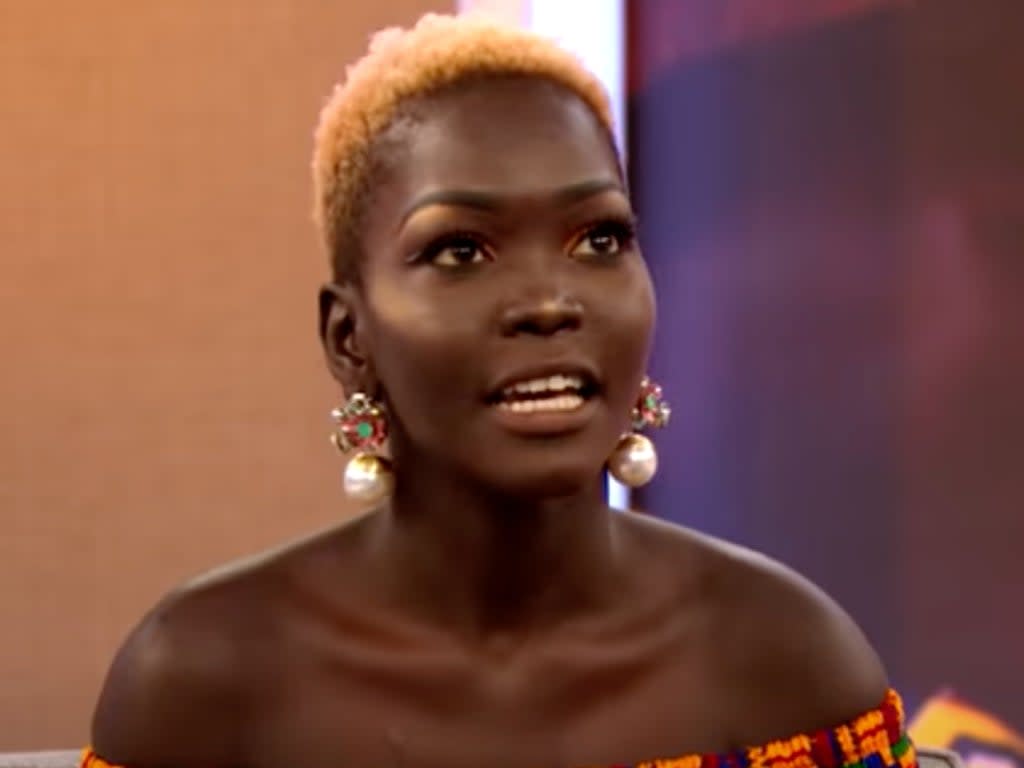 South Sudanese model Nyakim Gatwech, who pushed back on false claims that she held the record for “darkest human on Earth.