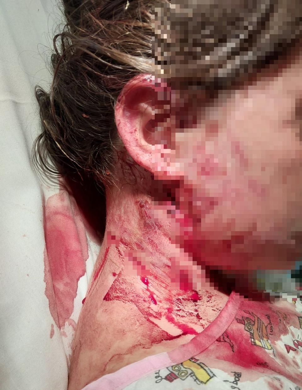 Ten-year-old girl was mauled by an XL bully in Doncaster on Monday (South Yorkshire Police)