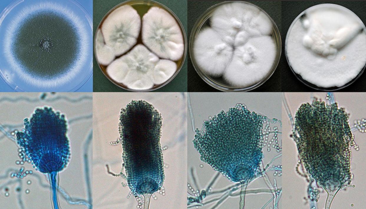 <span>Species of the <em>Aspergillus</em> genus are just one of the many fungi being researched at Australia’s National Mycological Reference Centre.</span><span>Photograph: University of Adelaide</span>