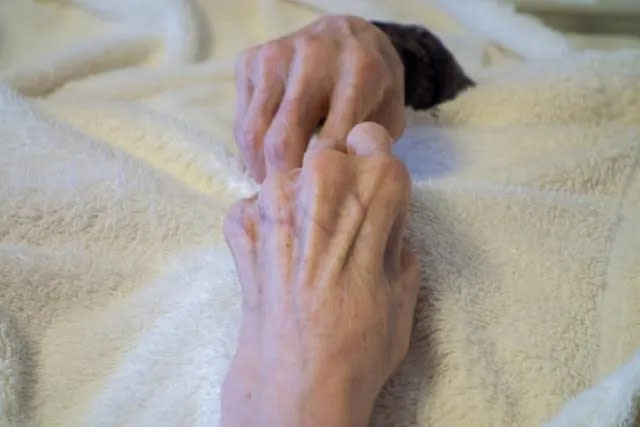 <strong>80歲的李奶奶由於疲倦、眼睛變黃，經家屬帶往醫院就醫，原以為是年紀大的關係，沒想到竟是膽道癌第4期。(圖／photoAC) </strong>