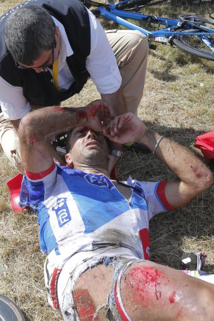 A doctor tends to William Bonnet of France after he crashed Monday. (AP Photo/Christophe Ena)