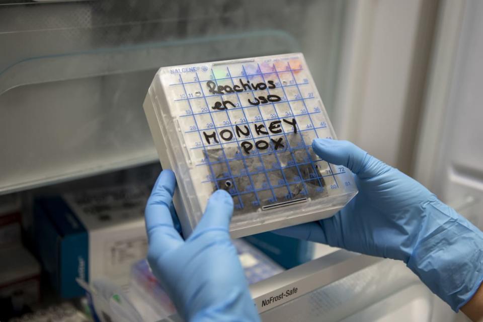 <div class="inline-image__caption"><p>A medical laboratory technician prepares to test suspected monkeypox samples at the microbiology laboratory of La Paz Hospital.</p></div> <div class="inline-image__credit">Pablo Blazquez Dominguez/Getty</div>