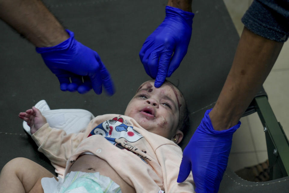 FILE - A Palestinian baby wounded in the Israeli bombardment of the Gaza Strip is treated in a hospital in Deir al-Balah on Tuesday, Nov. 14, 2023. The war in Gaza has sparked a humanitarian catastrophe that has prompted shortages of the most basic necessities. Among those hardest hit are babies, young children and their parents. That's because diapers and formula are hard to find or have prices that are increased to unaffordable prices. Parents are looking to inadequate or even unsafe alternatives. (AP Photo/Hatem Moussa, File)