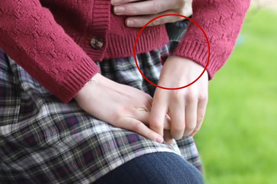 Princess Charlotte appears to be missing a part of her wrist in the image. Prince of Wales