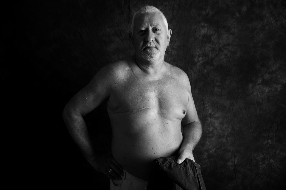 Steve McAllister, 67, from Cardiff, was diagnosed with breast cancer in 2010. <em>[Photo: Ami Barwell/PA Wire]</em>