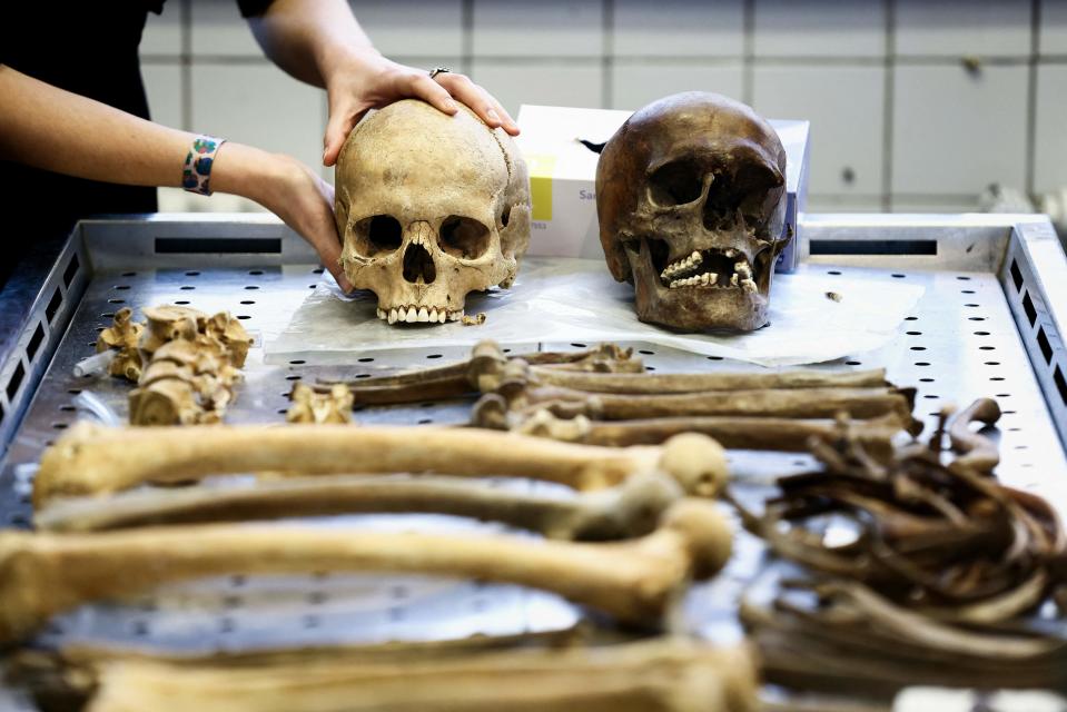 Belgian anthropologist Mathilde Daumas shows the skull of a soldier who fought in the Battle of Waterloo in 1815, in which the French Army under the command of Napoleon was defeated and marked the end of the Napoleonic Wars, at the Institute for Forensic Medicine of Liege, on Feb. 1, 2023.  / Credit: KENZO TRIBOUILLARD/AFP via Getty Images