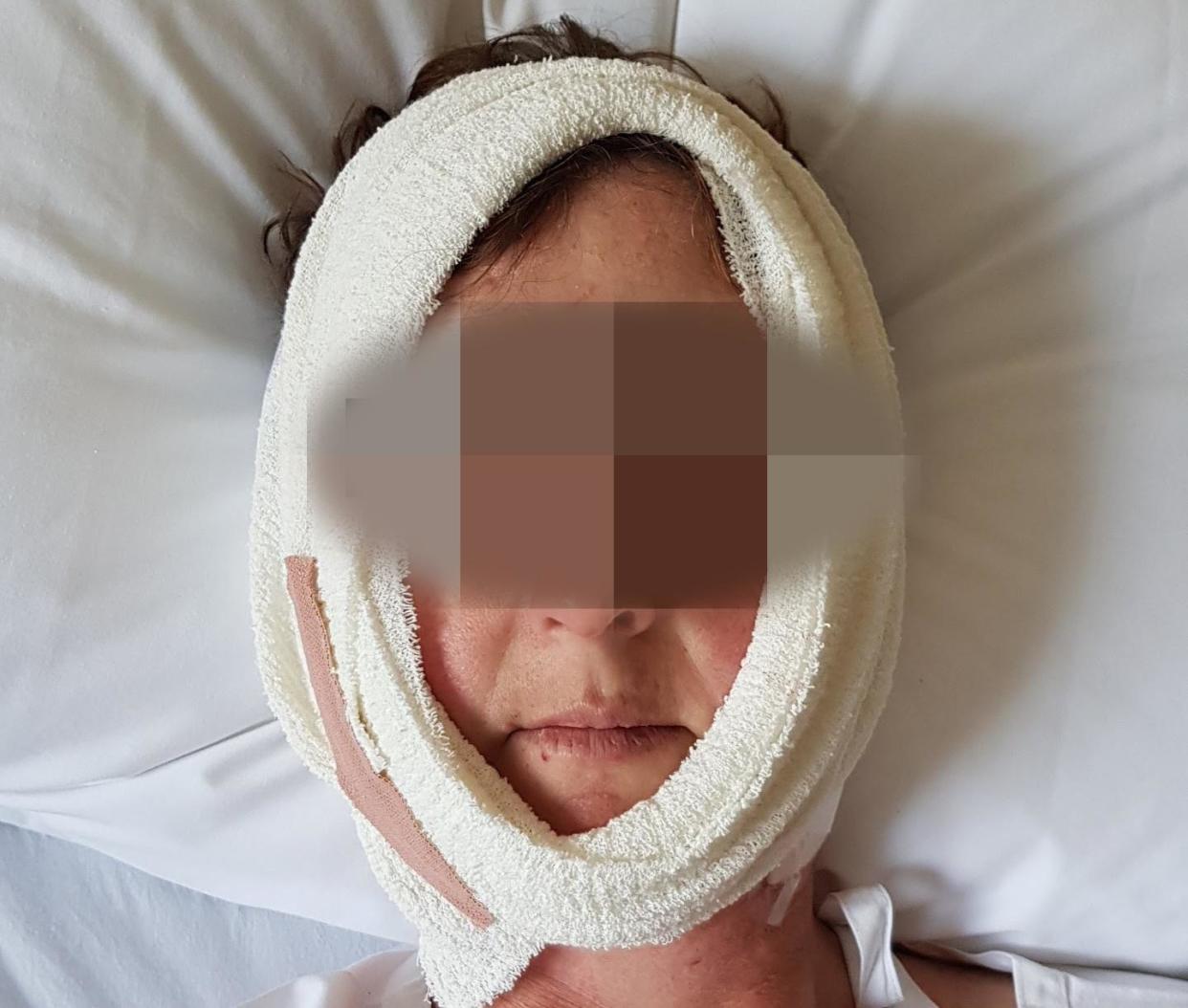 <span>Jordan (not her real name) made a complaint to the medical regulator after jaw surgery under the care of Dr George Dimitroulis.</span><span>Photograph: Supplied</span>