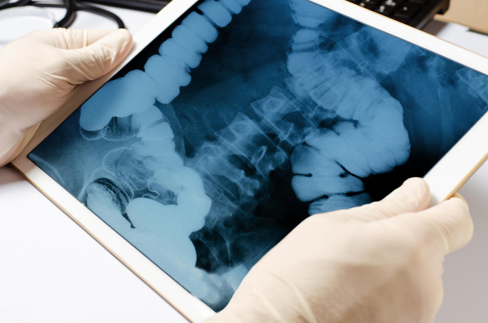 Close-up of gloved hands holding a tablet displaying a medical X-ray image of a human digestive system