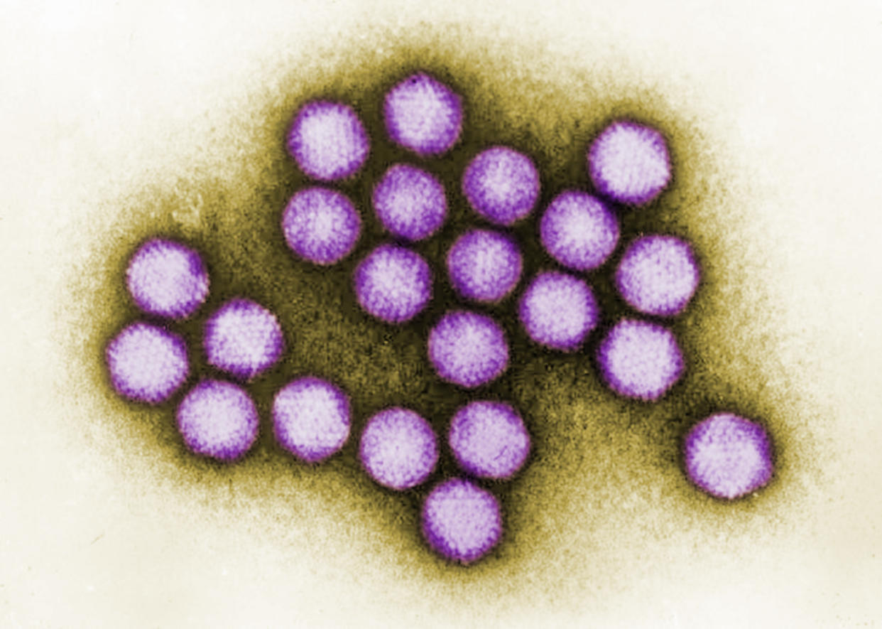 Transmission electron microscopic (TEM) image of some of the ultrastructural details exhibited by a small cluster of adenovirus virions. (Dr. G. William Gary, Jr. / CDC)