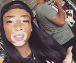 <p>Is dating Candian model Winnie Harlow, whose YouTube video “Vitiligo: A Skin Condition, not a Life Changer”, was an Internet sensation </p>