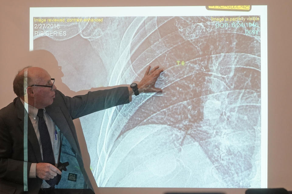 Dr. Wendell Gibby points to rib fractures on Terry Sanderson's X-rays on Wednesday, March 22, 2023, in Park City, Utah. Gibby testified in support of Sanderson's lawsuit blaming actor Gwyneth Paltrow for the crash. He said Sanderson's head trauma was likely caused by a skier crashing into him. (AP Photo/Rick Bowmer, Pool)