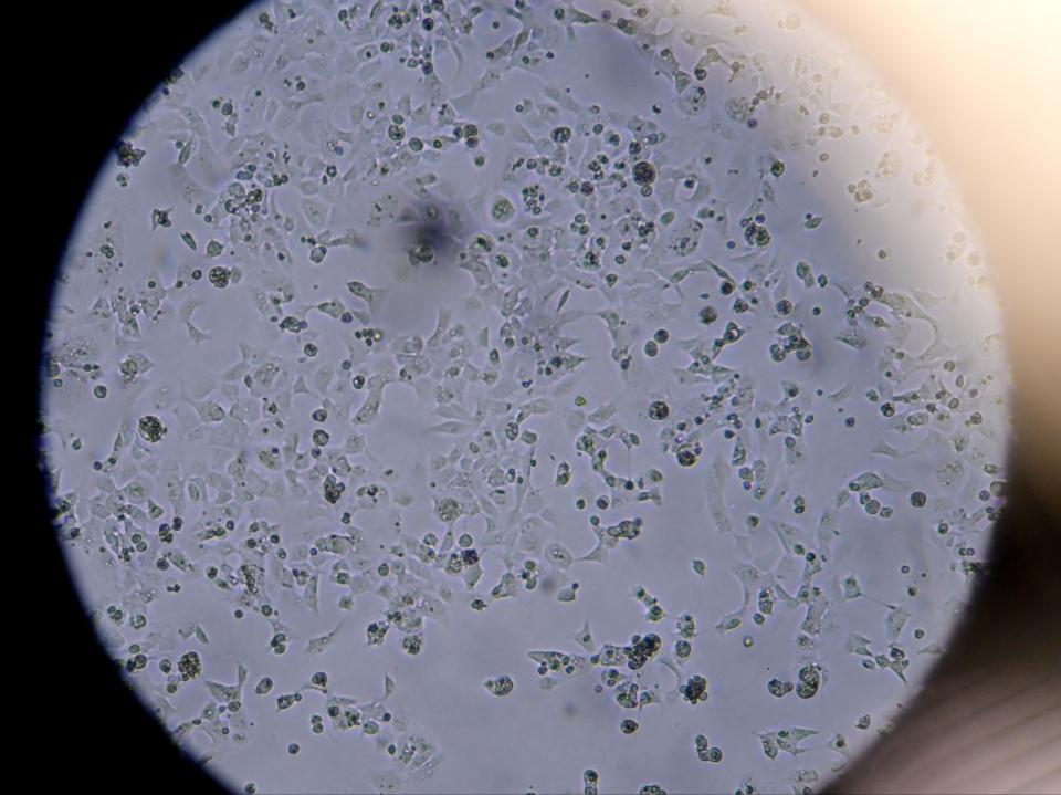 Las células que contienen Sars-CoV-2 se ven a través de un microscopio en el laboratorio Stabilitech en Burgess Hill, sureste de Inglaterra (AFP via Getty Images)