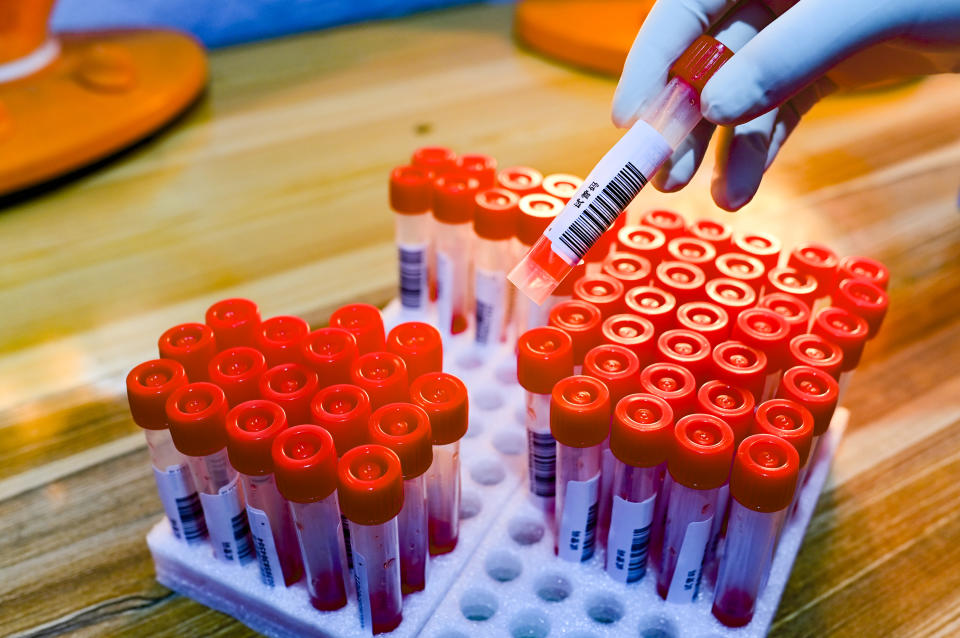 HOHHOT, CHINA - NOVEMBER 30, 2022 - A medical worker prepares nucleic acid sampling at a residential complex in Hohhot, Inner Mongolia, China, Nov 30, 2022. (Photo credit should read CFOTO/Future Publishing via Getty Images)