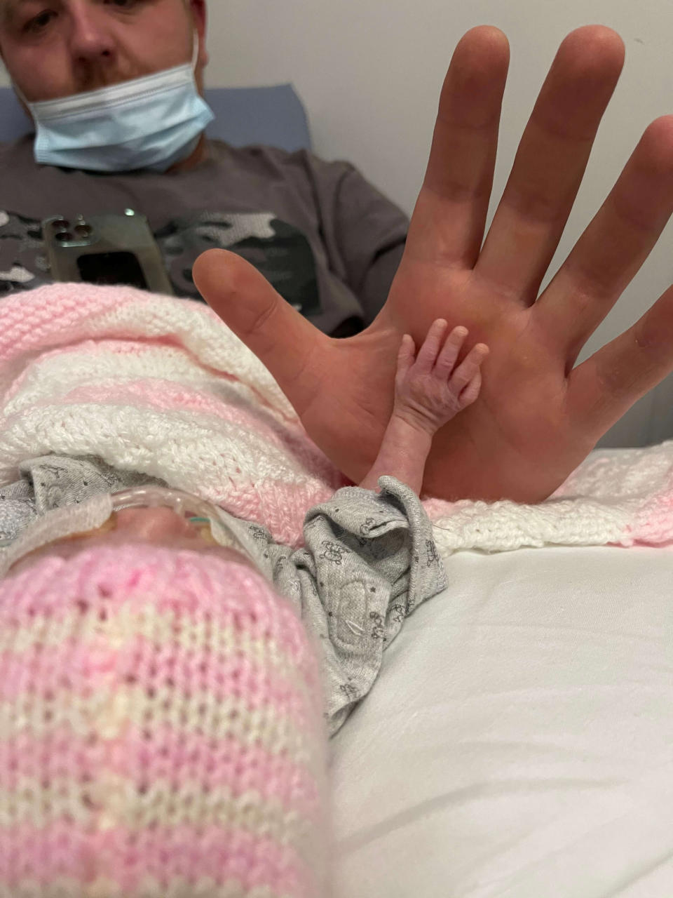 Baby Isla's tiny hand just after birth. (Lauren Ormston/SWNS)