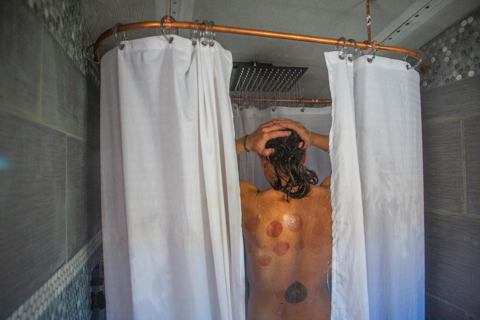 Paula showers in her handmade bathroom on the school bus, which includes a compost toilet and bathtub made from a metal trough. She suffered a major back injury years ago, and the bruising on her back is from ‘cupping,’ a form of alternative medicine often used to treat muscle pain, which she lets Max practice on her when she is stressed.<span class="copyright">Nina Riggio for TIME</span>