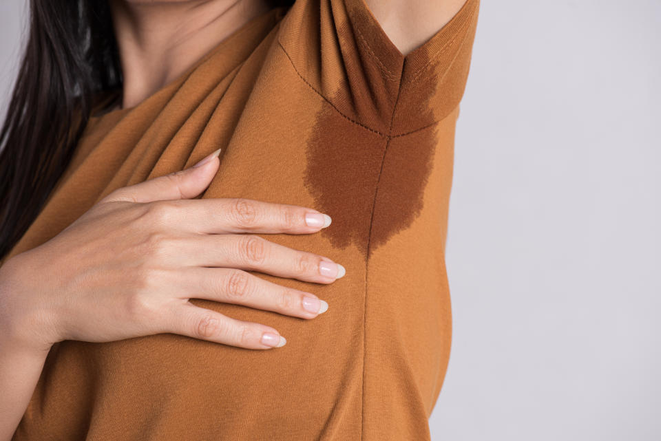 Woman suffering from excessive sweating. (Getty Images)