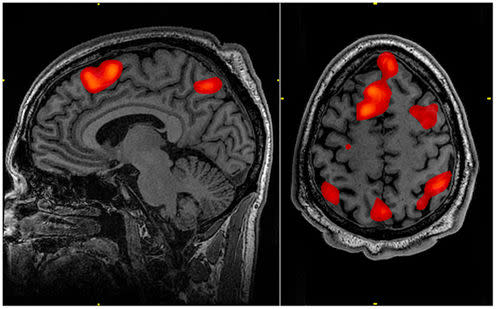 <span class="caption">FMRI scan during working memory tasks</span> <span class="attribution"><span class="source">John Graner, Neuroimaging Department, National Intrepid Center of Excellence, Walter Reed National Military Medical Center, 8901 Wisconsin Avenue, Bethesda, MD 20889, USA</span></span>