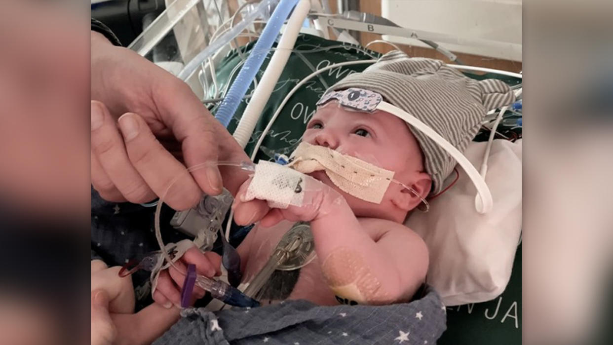  Photo of a baby lying down in a hospital with wires and medical equipment attached it him. He's holding the hand of an adult whose face is out of frame. 