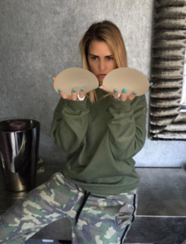 Katie Price to sell her old breast implants for charity, Celebrity