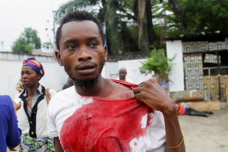 An injured Congolese opposition supporter walks outside the headquarters of the Union for Democracy and Social Progress (UDPS) during violent protests to press President Joseph Kabila to step down, in the Democratic Republic of Congo's capital Kinshasa, September 20, 2016. REUTERS/Kenny Katombe/File Photo