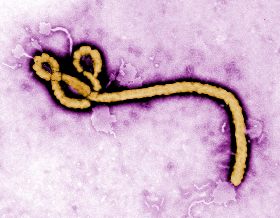 伊波拉(Ebola)病毒(圖：取自美國疾病管制預防中心)