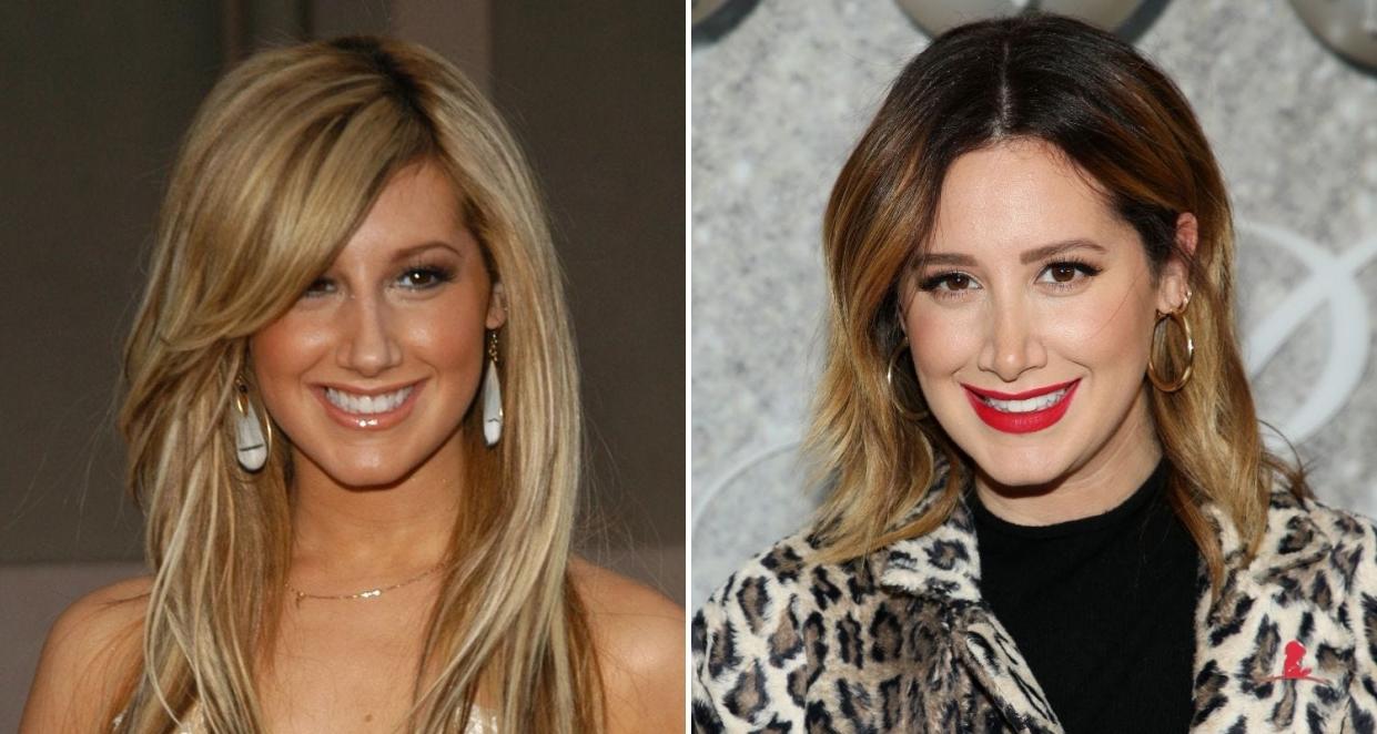 ashley tisdale opened up about nose job experience
