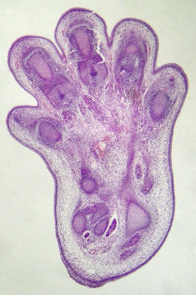 The toes of this embryonic mouse foot are forming through apoptosis. <a href="https://commons.wikimedia.org/wiki/File:Embryonic_foot_of_mouse.jpg" rel="nofollow noopener" target="_blank" data-ylk="slk:Michal Maňas/Wikimedia Commons;elm:context_link;itc:0;sec:content-canvas" class="link ">Michal Maňas/Wikimedia Commons</a>, <a href="http://creativecommons.org/licenses/by-sa/4.0/" rel="nofollow noopener" target="_blank" data-ylk="slk:CC BY-SA;elm:context_link;itc:0;sec:content-canvas" class="link ">CC BY-SA</a>