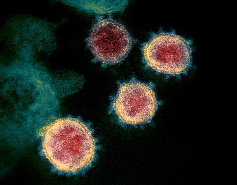圖為美國專家近日公布在電子顯微鏡上觀察到的新型冠狀病毒影像。（翻攝自NIAID-RML）